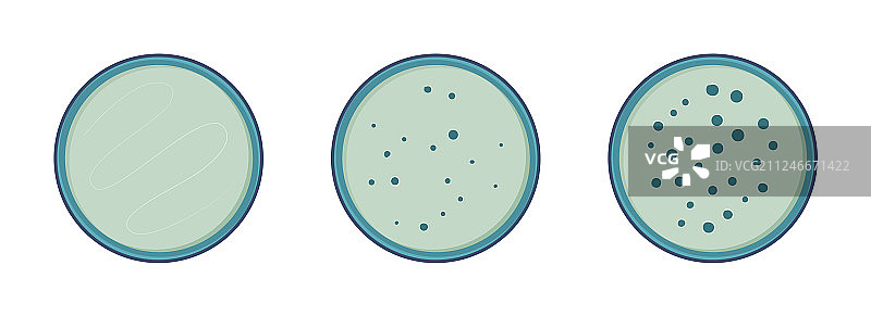 菌落细菌在培养皿中生长3个阶段图片素材