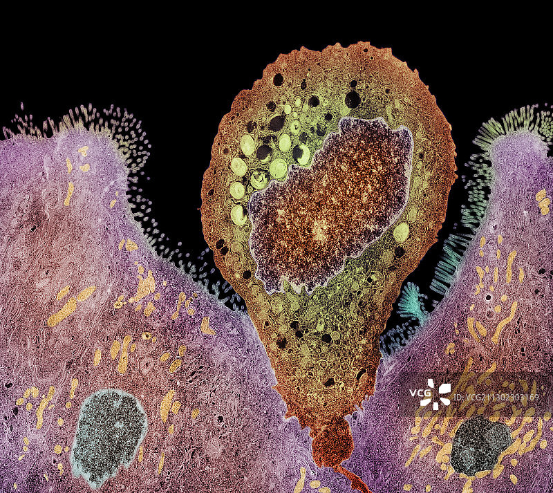 肠子龙孢子寄生虫，彩色 TEM图片素材