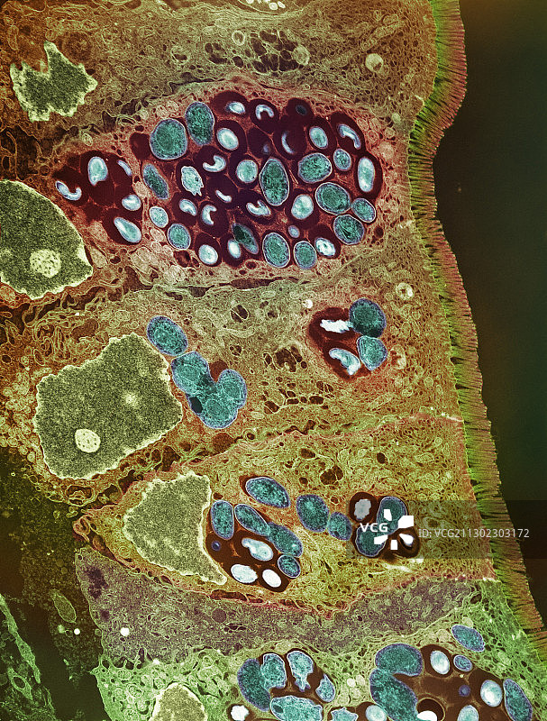 原生动物孢子形成，TEM图片素材
