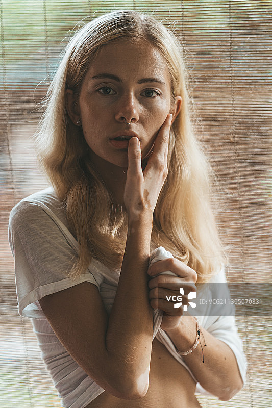一个美丽的女人的肖像与白癜风色素沉着，圣彼得堡，俄罗斯图片素材