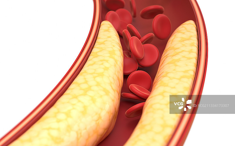 血管中的脂肪与红细胞 3D渲染图片素材