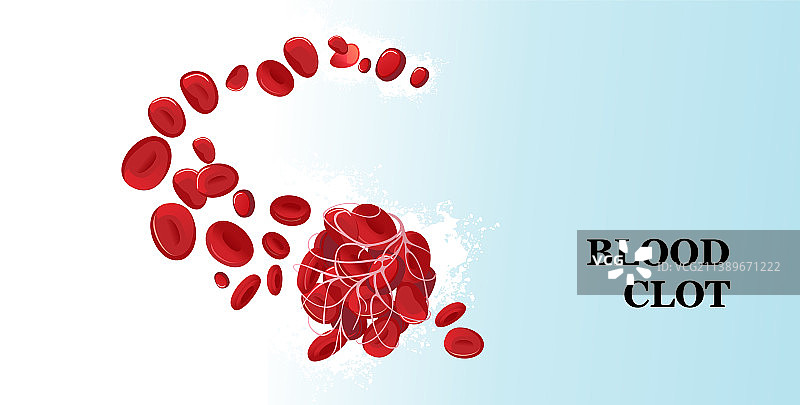 血块血栓医学海报图片素材