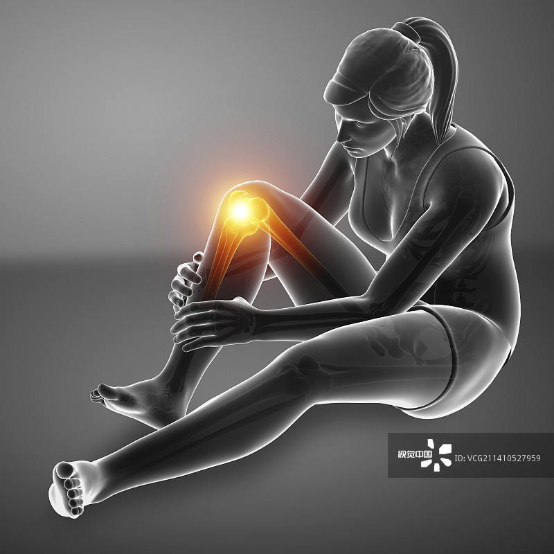 膝盖疼痛的妇女，插图图片素材