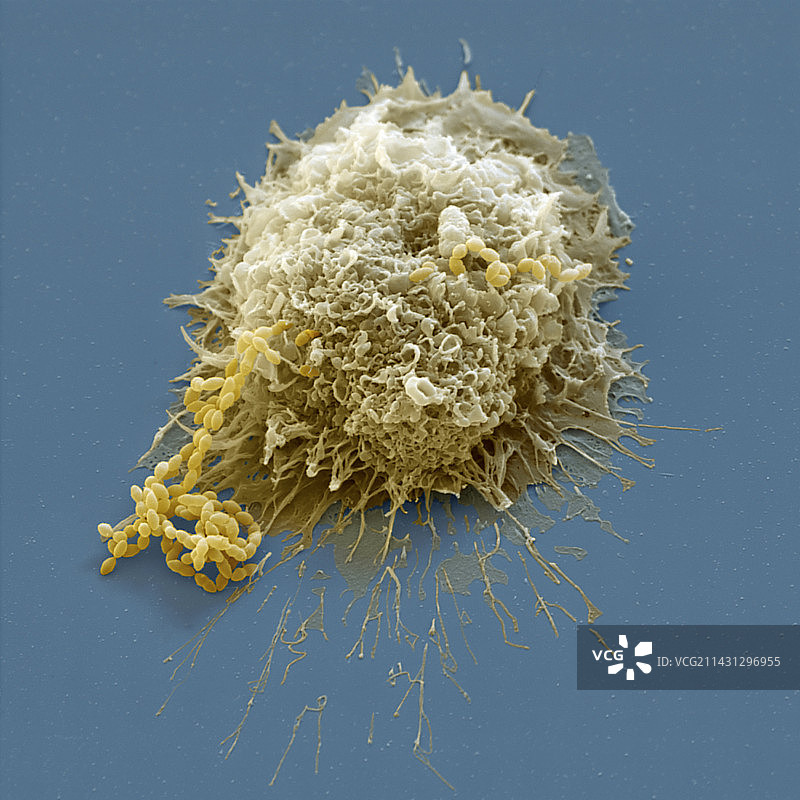巨噬细胞攻击细菌，SEM图片素材