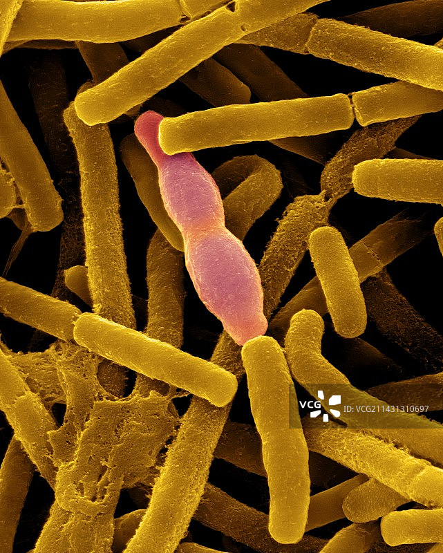 炭疽芽孢杆菌，SEM图片素材