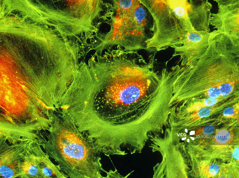 肾癌细胞的免疫荧光LM图片素材