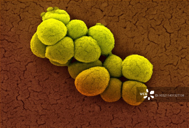 黄体微球菌，扫描电镜图片素材