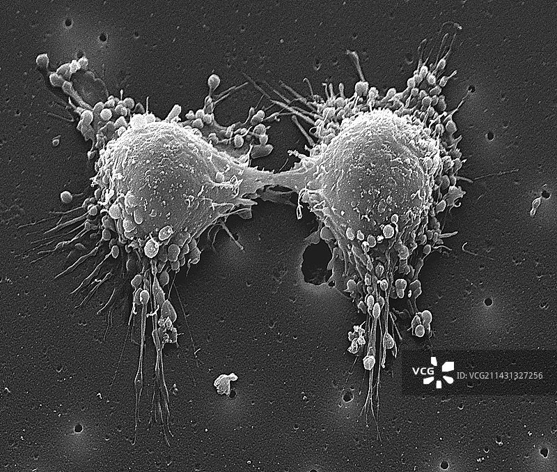 癌细胞分裂，扫描电镜图片素材