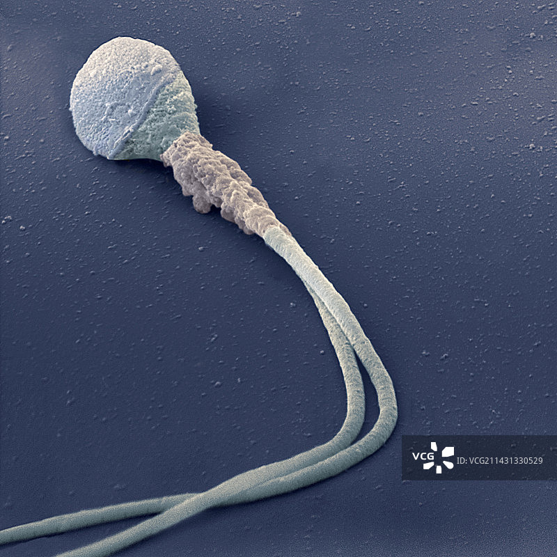 畸形精子细胞，扫描电镜图片素材
