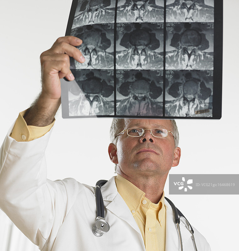 看x光片的医生图片素材