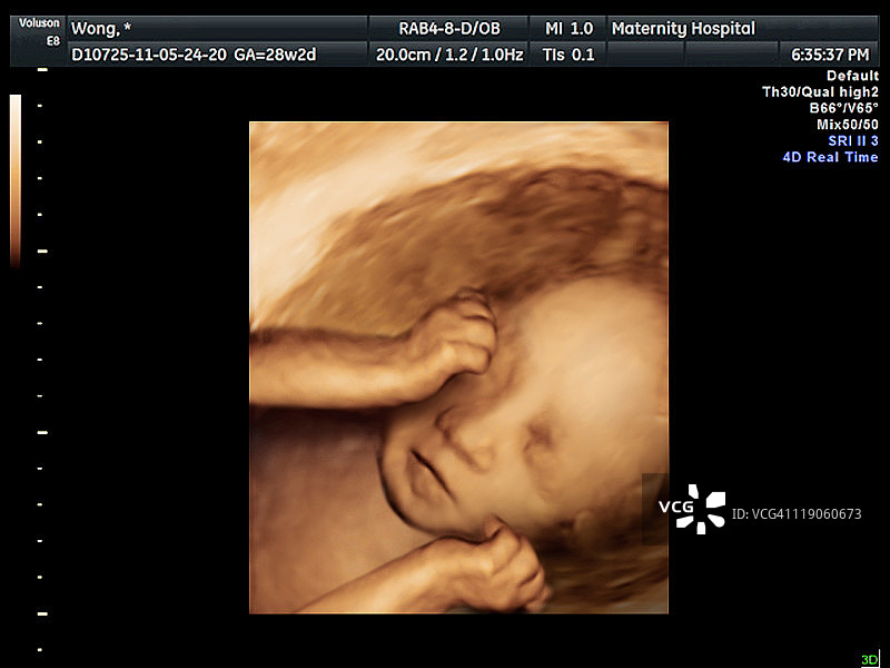 子宫内试管婴儿4D扫描图片素材