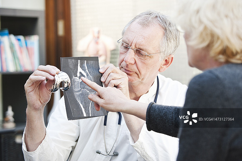 成熟的医学表现为女性患者的x线和膝关节置换术图片素材