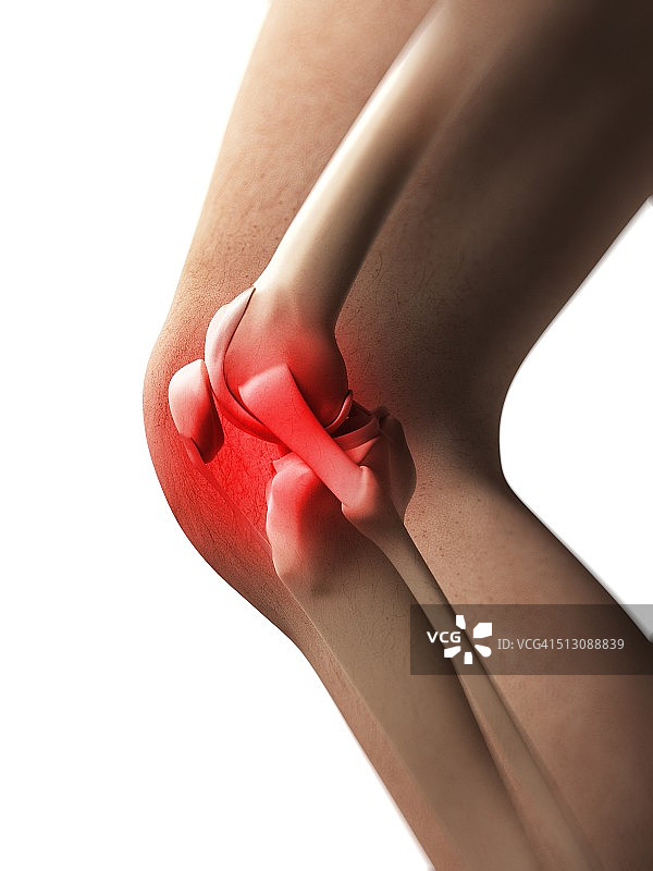 人类膝盖疼痛，艺术品图片素材