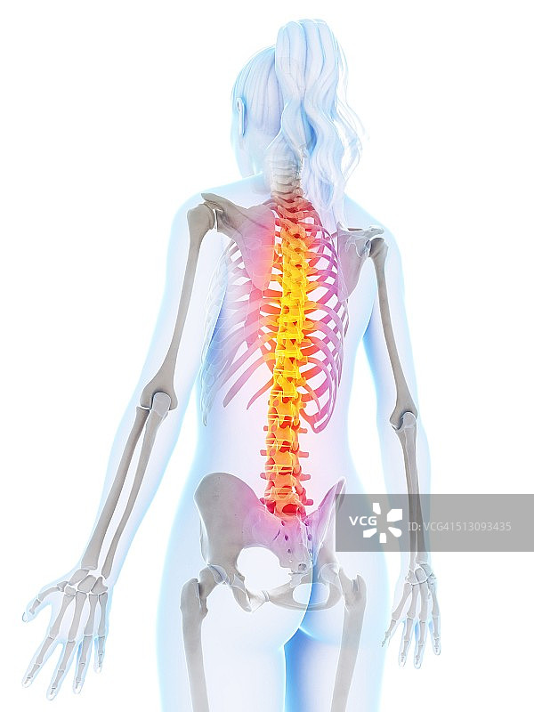 人类脊椎疼痛，艺术品图片素材