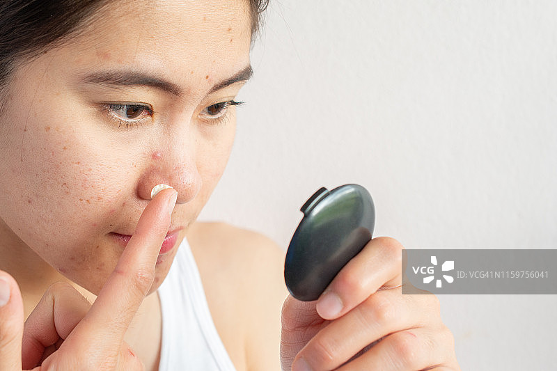 肖像的年轻亚洲妇女应用痤疮霜在她的脸上解决痤疮炎症看口袋镜子。图片素材