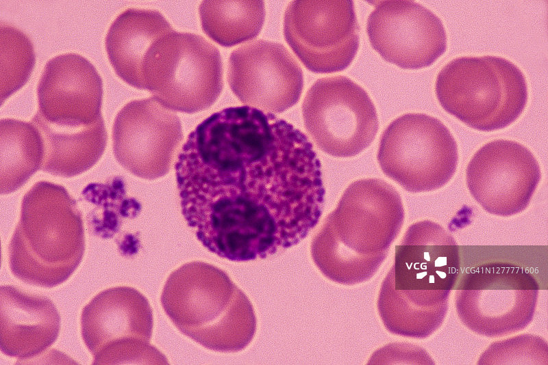 嗜酸性粒细胞——一种白细胞或白细胞——在哮喘等过敏中扮演着重要角色，红细胞和血小板也显示为600X图片素材