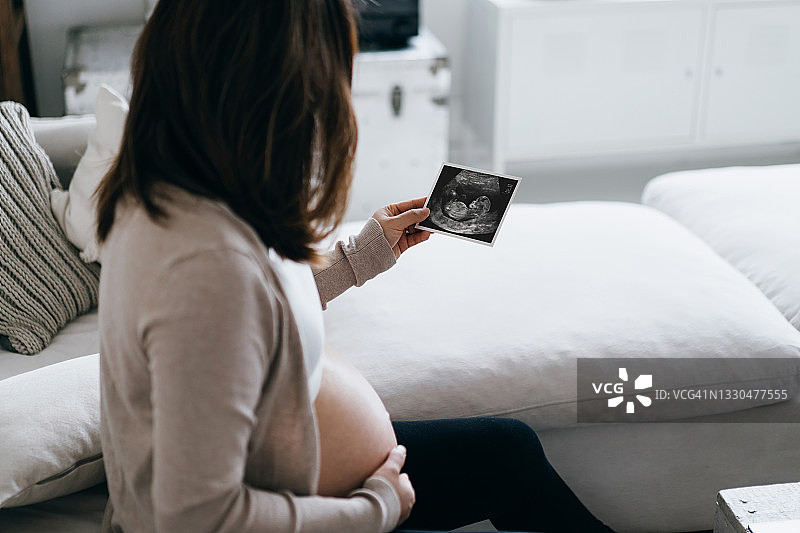 一位可爱的年轻亚洲孕妇躺在家里的沙发上，一边抚摸自己的肚子，一边看着宝宝的超声波扫描照片。孕妇。期待一种新的生活理念图片素材