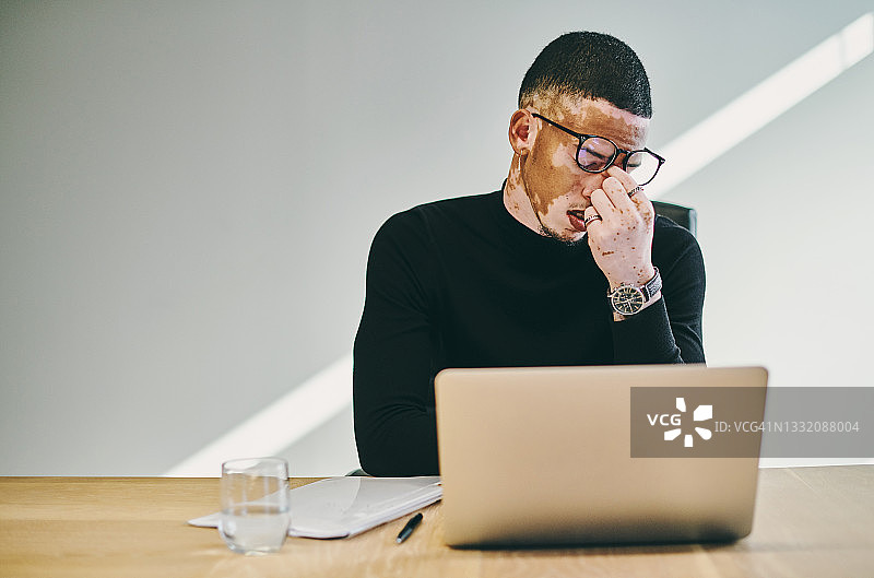 一名年轻的商人在现代化的办公室里使用笔记本电脑，看上去压力很大图片素材