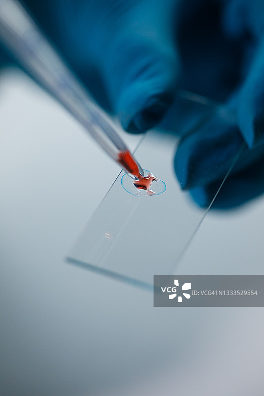 实验室技术员将血液样本滴在显微镜载玻片上图片素材