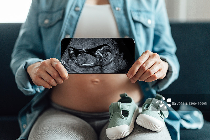 妊娠保健与技术图片素材