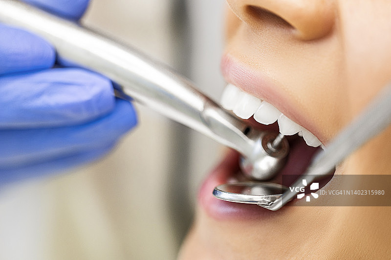 特写图像的妇女的嘴在牙医与牙钻图片素材