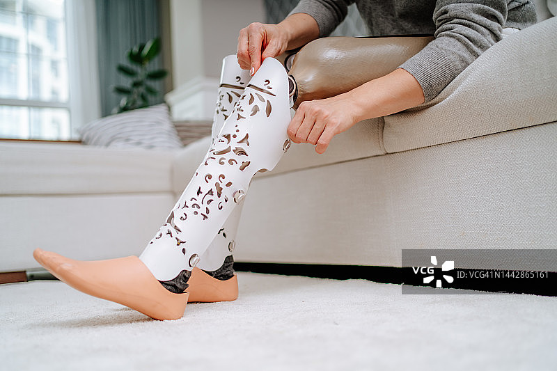 新型人工假肢在腿部、身体护理中的应用。女人坐在沙发上，安装新的假肢图片素材