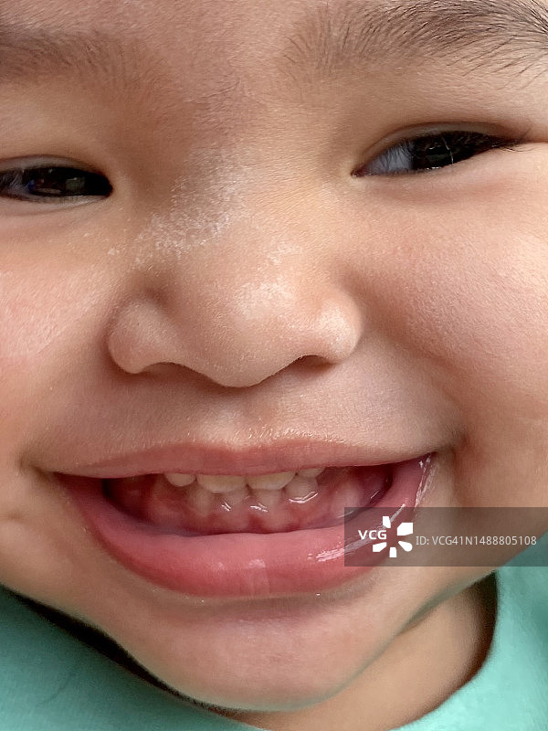 小女孩为检查牙齿及口腔健康而拍摄的口腔特写图片素材