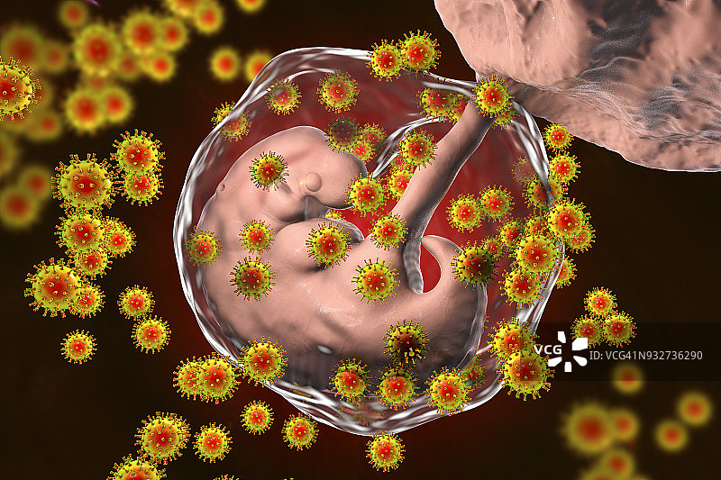 艾滋病毒感染人类胚胎，概念说明图片素材