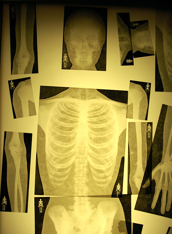 骨骼x射线图片下载