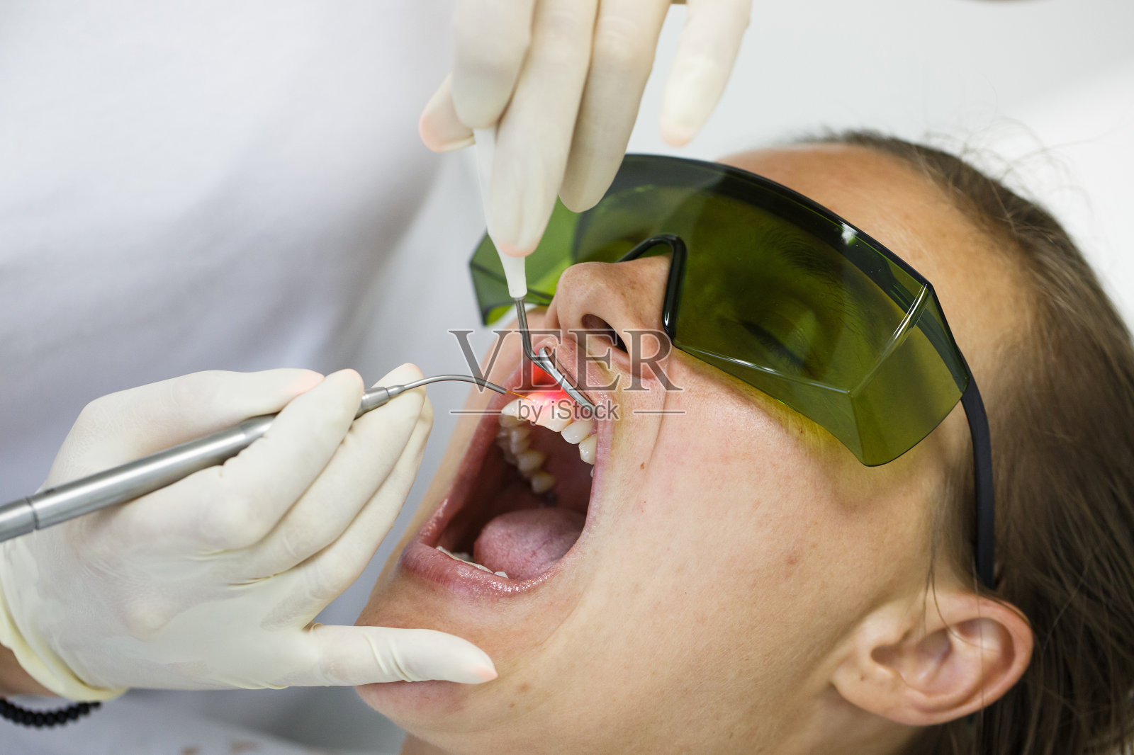 牙医使用现代二极管牙科激光照片摄影图片