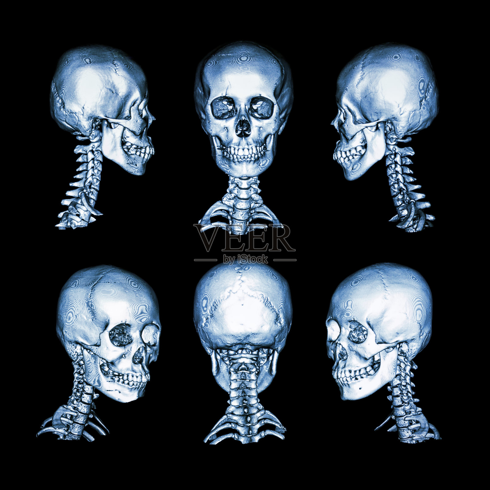 正常的人类颅骨和颈椎。所有的方向照片摄影图片