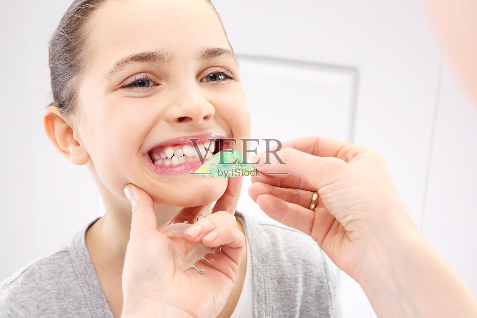 儿童牙齿矫正器照片摄影图片