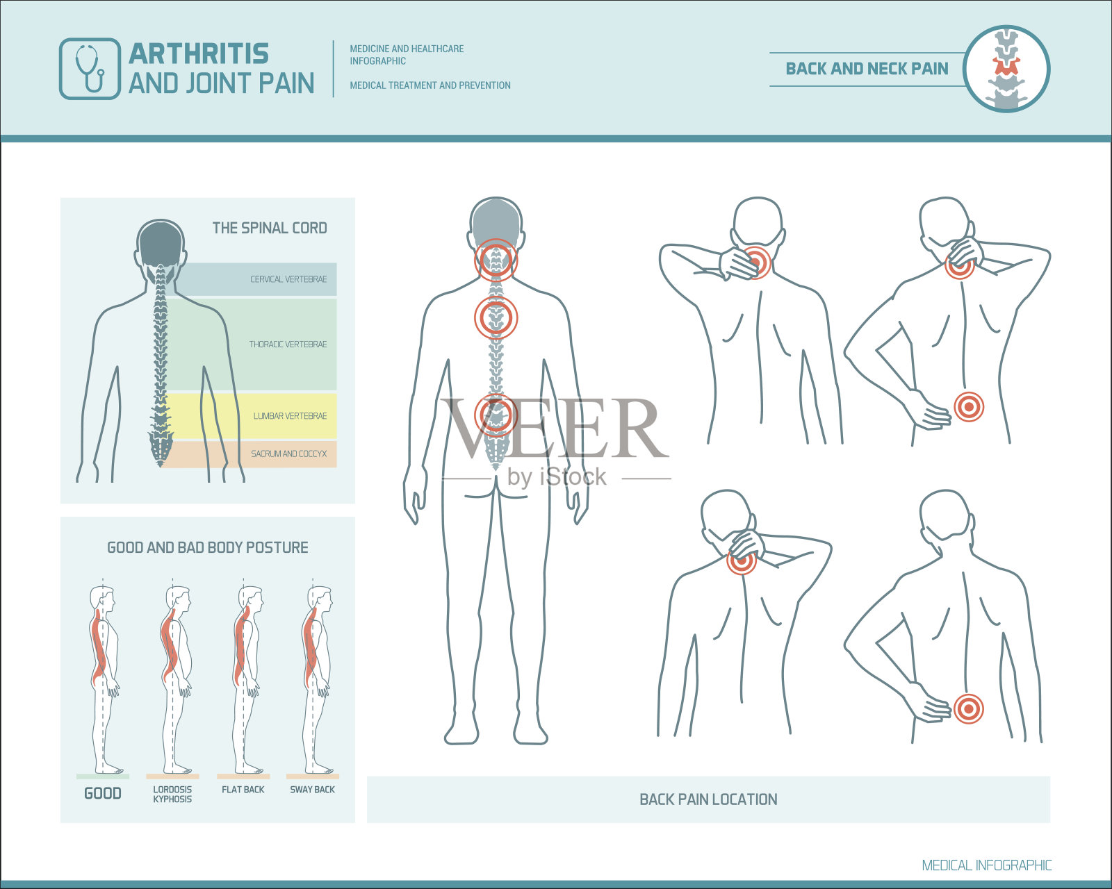 背部疼痛信息图表插画图片素材