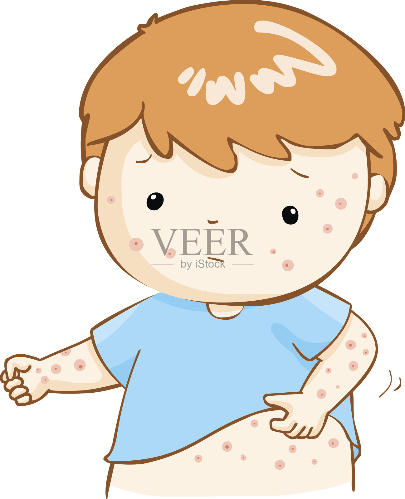 男孩抓痒疹子在他的身体载体插画图片素材