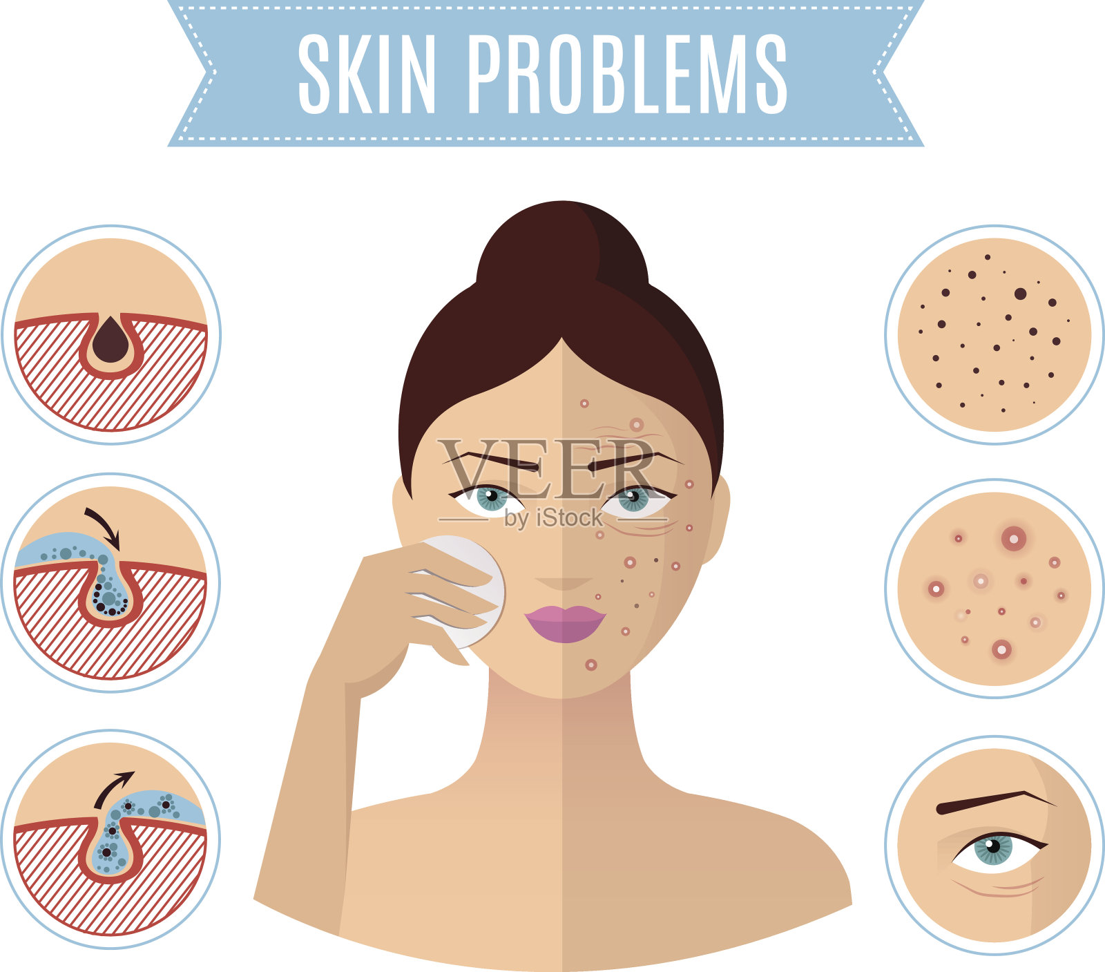 皮肤问题解决，痤疮治疗和清洁毛孔为完美女人的脸矢量图标插画图片素材