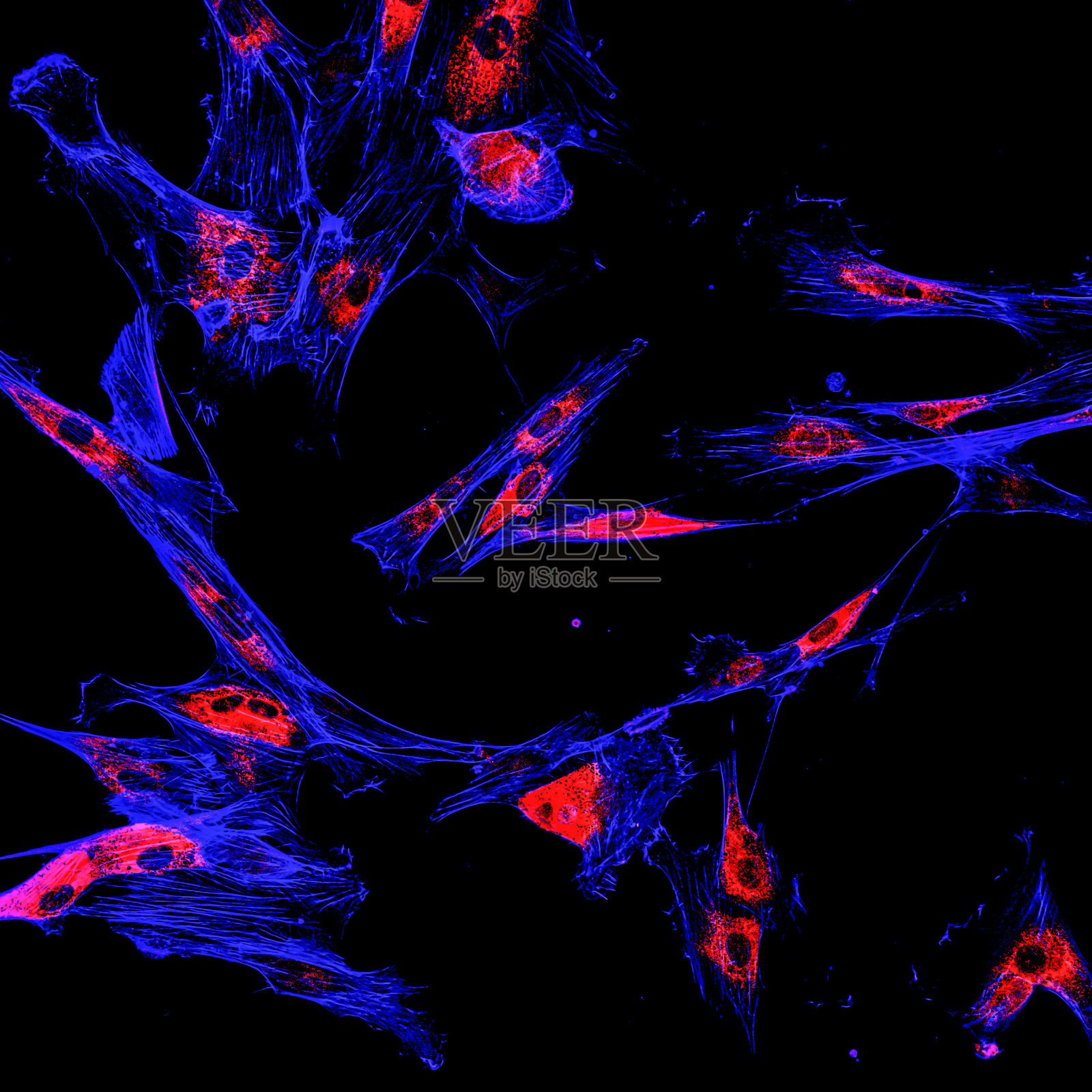 黑色素瘤癌细胞的免疫荧光共聚焦成像照片摄影图片