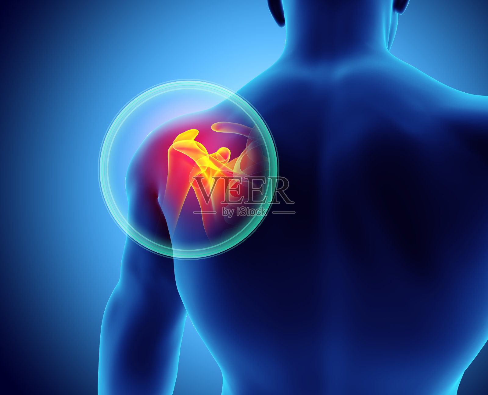 肩部疼痛的骨骼x光，3D插图。照片摄影图片
