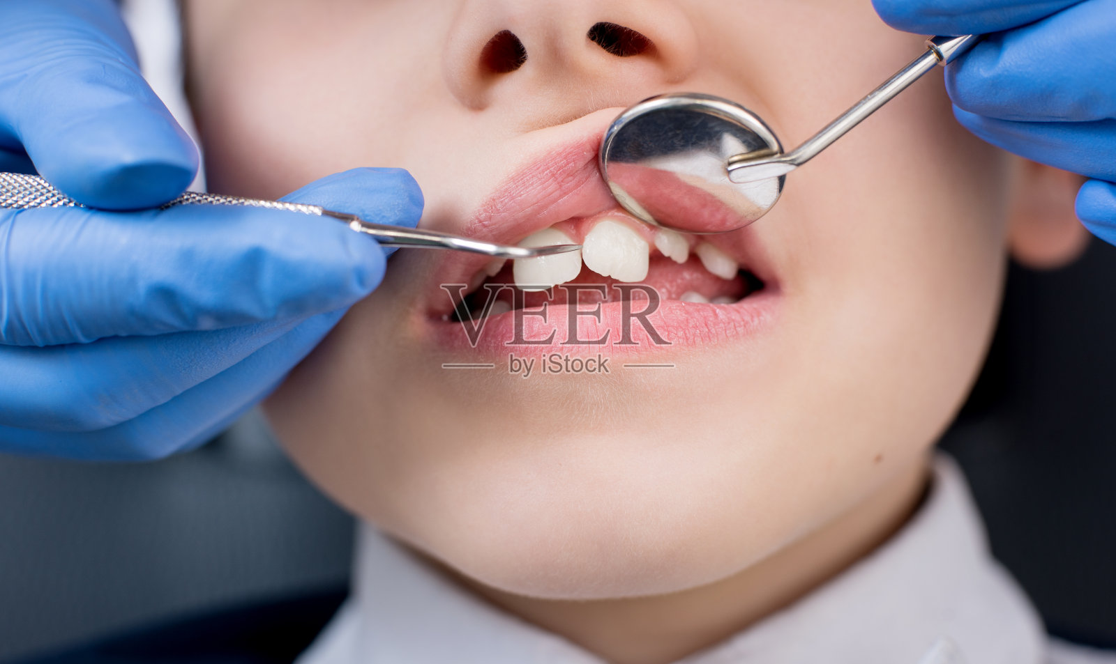 牙科医生的手在牙科诊所使用牙科工具-探针和镜子检查男孩病人的牙齿的特写。牙科照片摄影图片