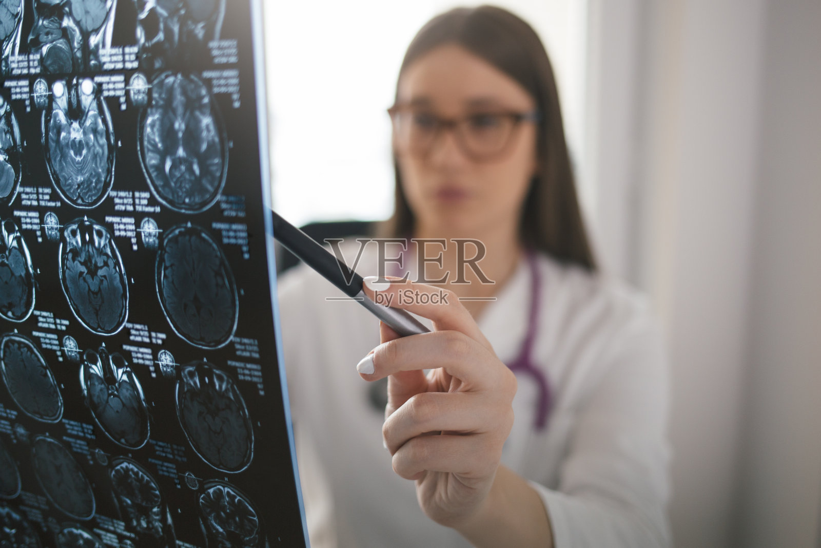 女医生指着脑部核磁共振扫描照片摄影图片