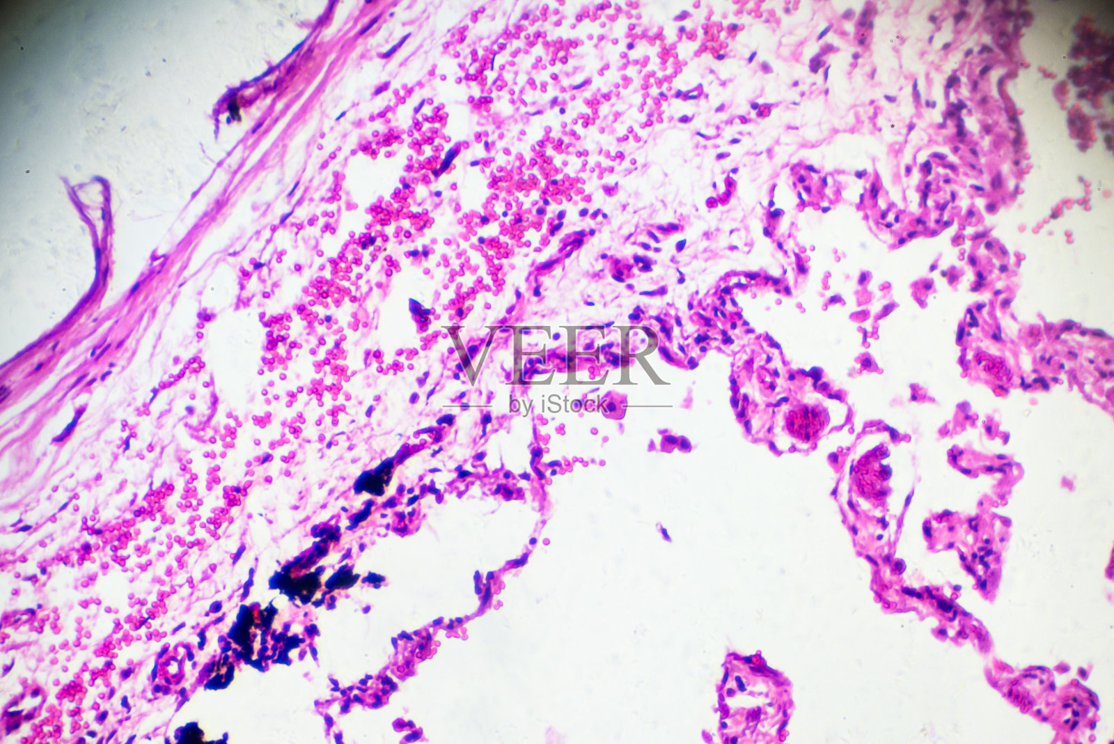 慢性支气管炎不同部位显微镜放大照片摄影图片