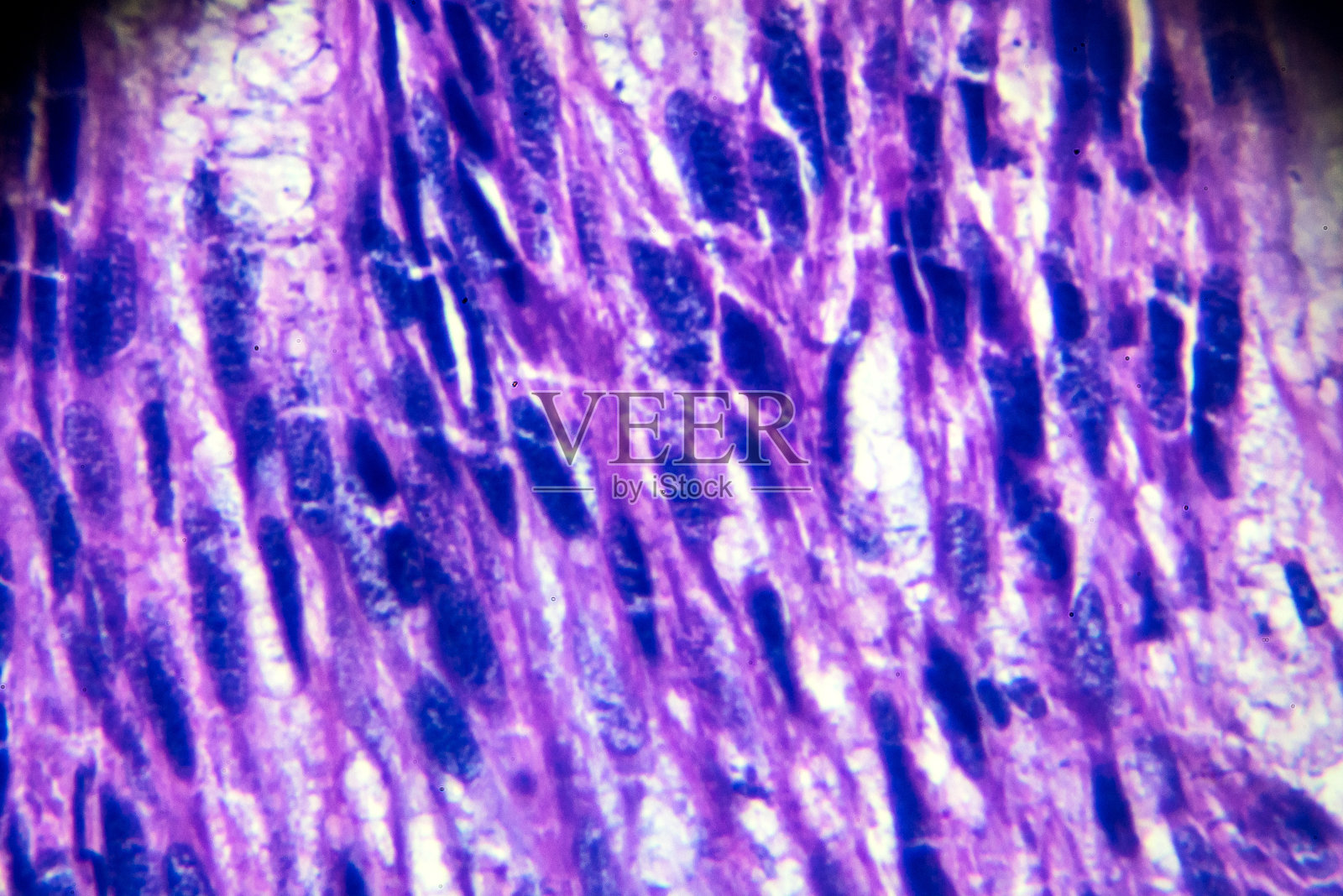 光镜下子宫平滑肌瘤活检标本照片摄影图片