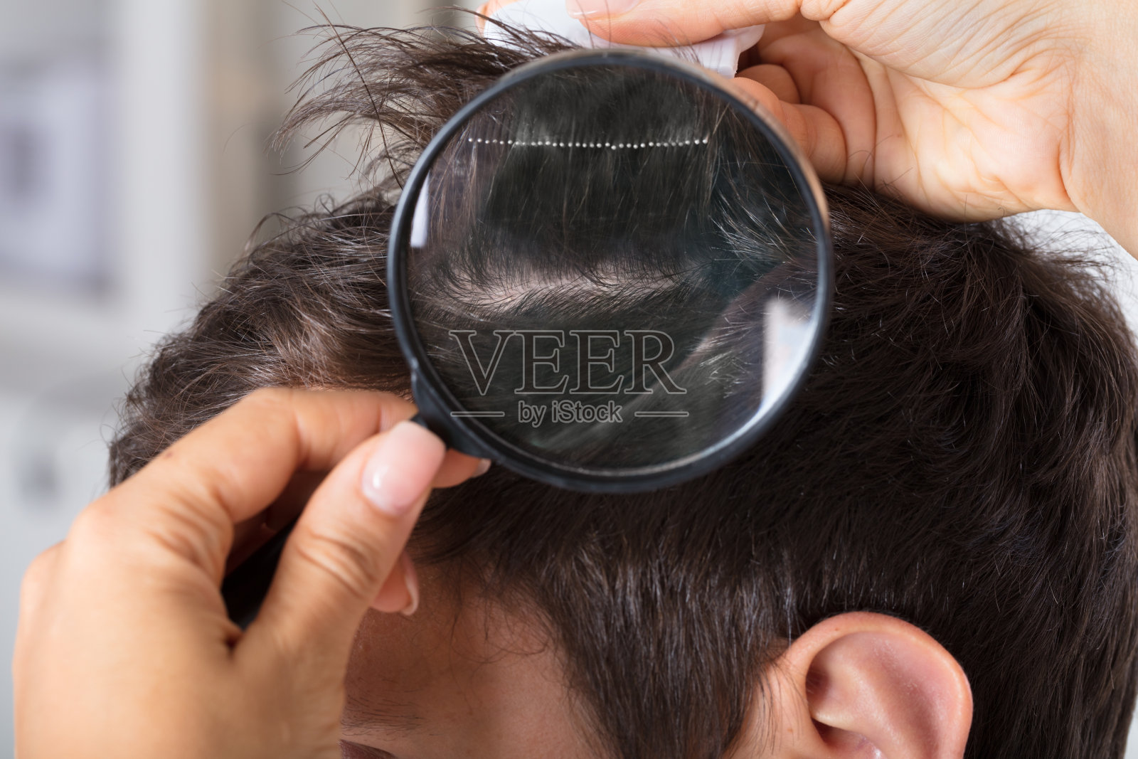 皮肤科医生用放大镜检查病人的头发照片摄影图片