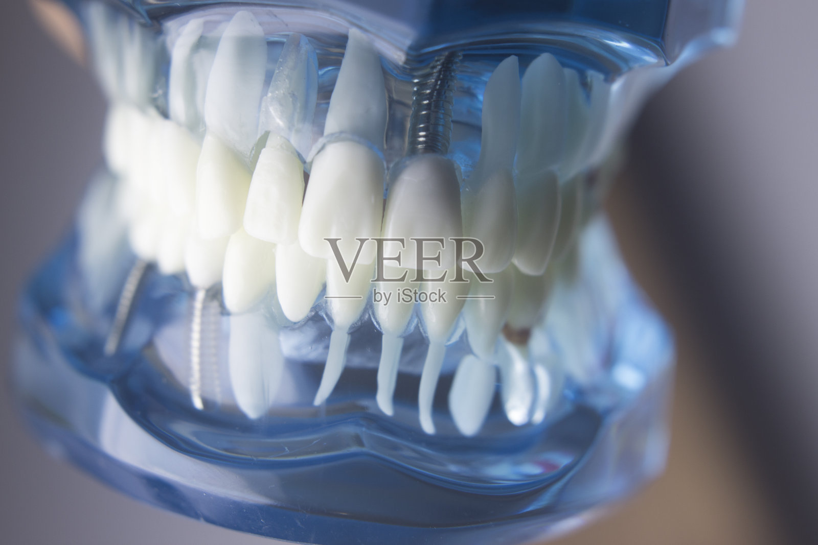 牙科学生学习教学模式展示牙齿、牙根、牙龈、牙龈疾病、蛀牙和牙菌斑。照片摄影图片