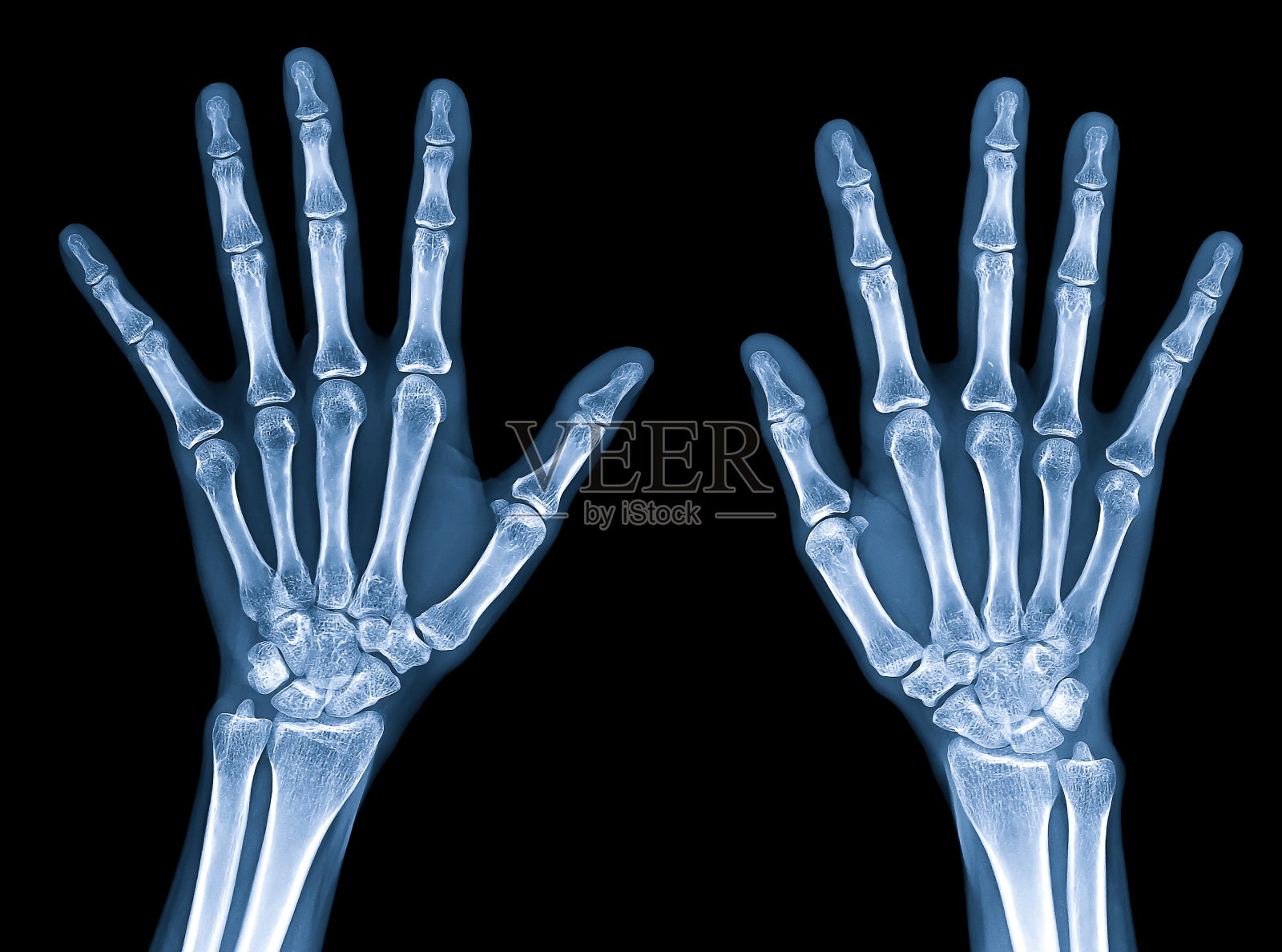 x射线图像的正常妇女的手孤立在黑色背景与剪切路径照片摄影图片