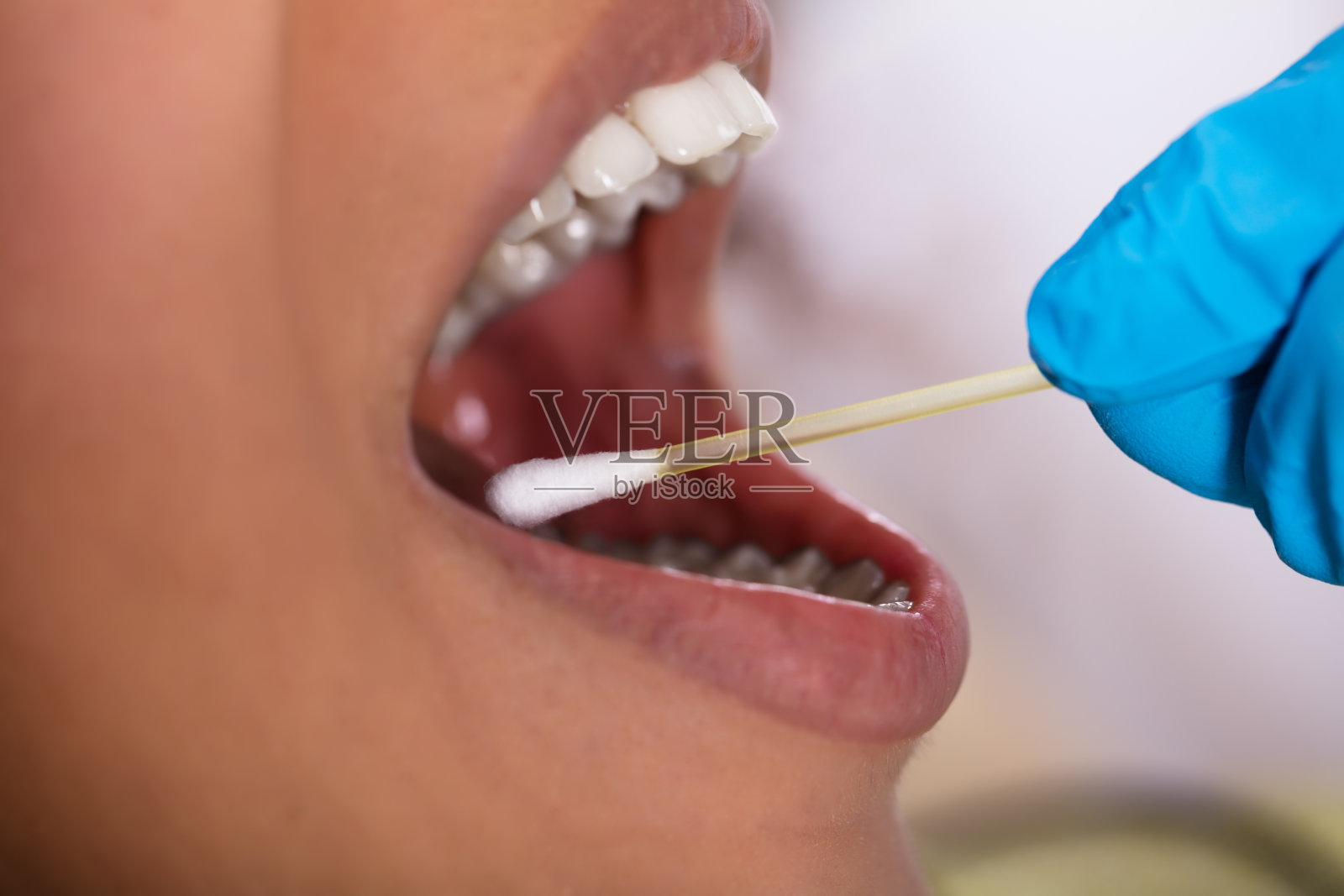 牙医用棉签做口腔唾液测试照片摄影图片