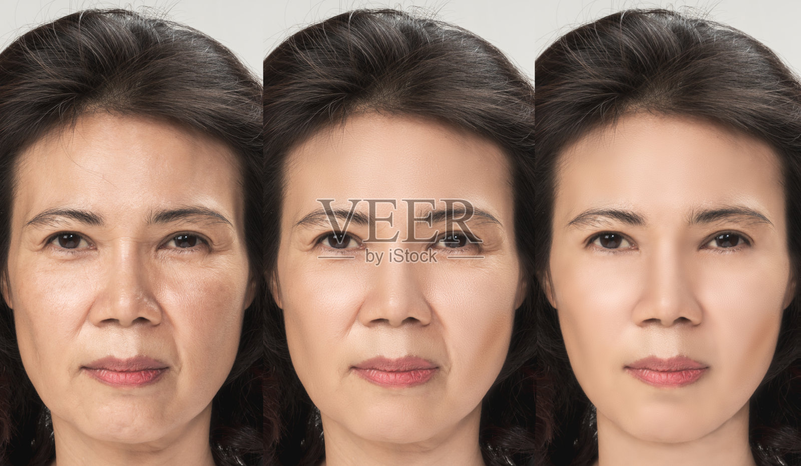 抗衰老过程，亚洲女性面部肌肤具有抗衰老的程序，嫩肤、提拉、紧致面部肌肤，恢复青春抗皱肌肤。老与年轻的概念。照片摄影图片