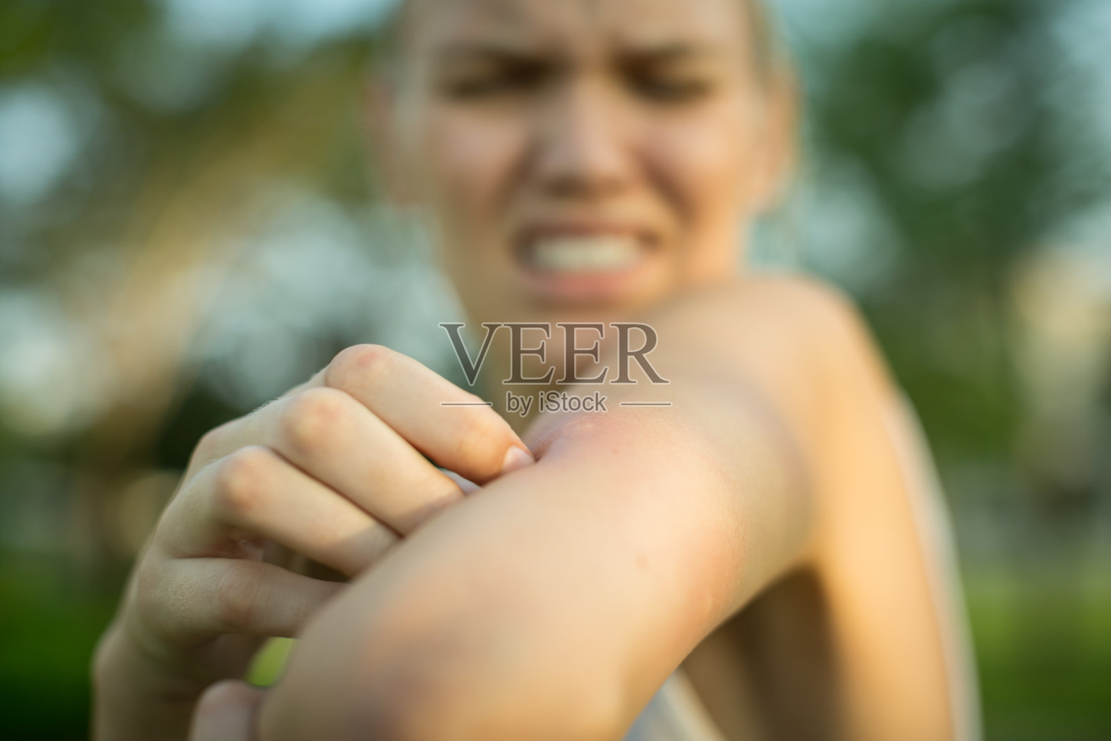 一个女人在抓挠她被蚊子叮咬的地方。热带气候危险。照片摄影图片