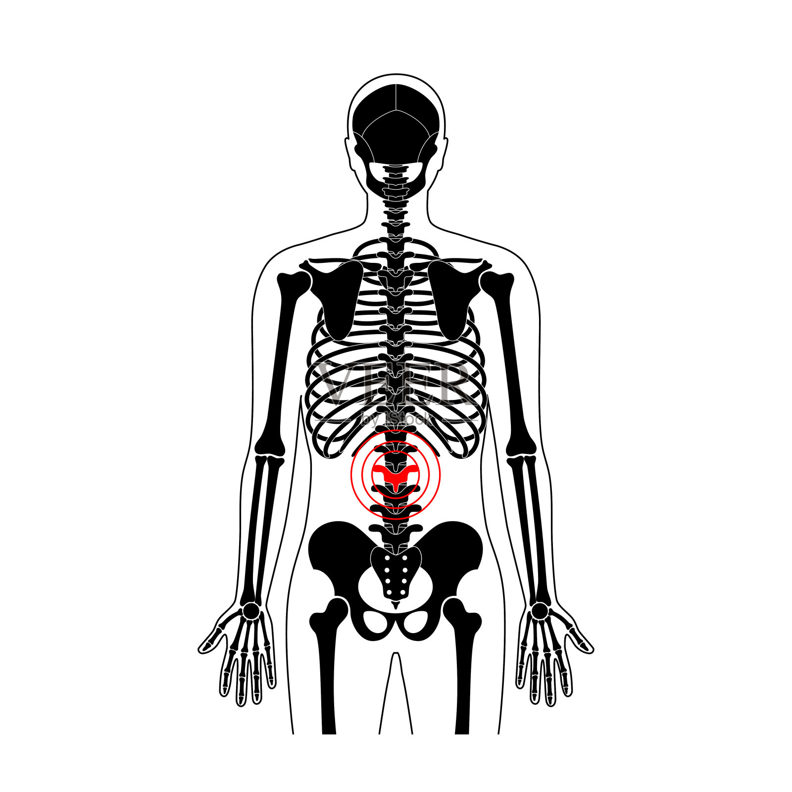 人体脊柱疼痛矢量插图插画图片素材