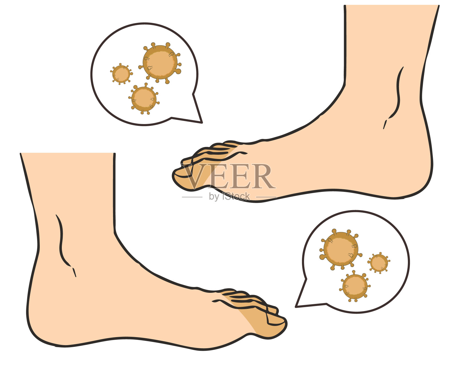 足部细菌方面插画图片素材