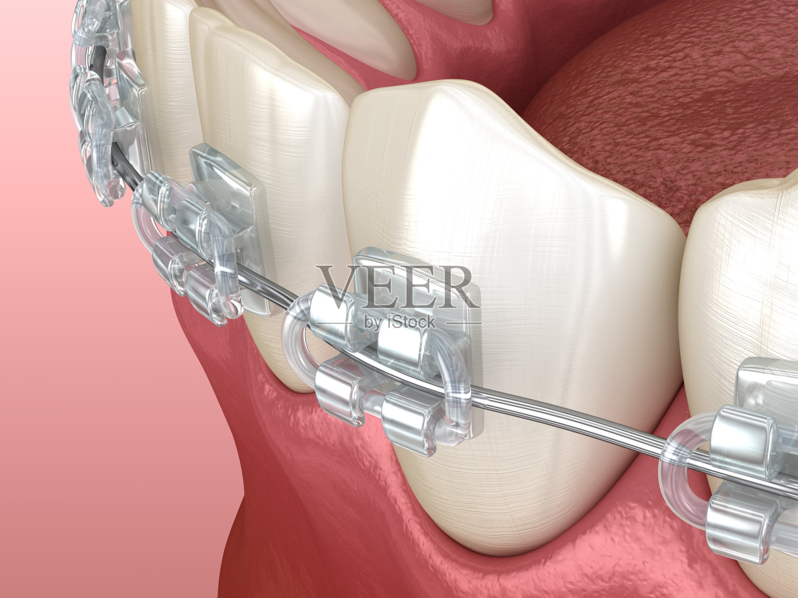 下颌和清晰的牙架。医学上准确的牙科3D插图照片摄影图片
